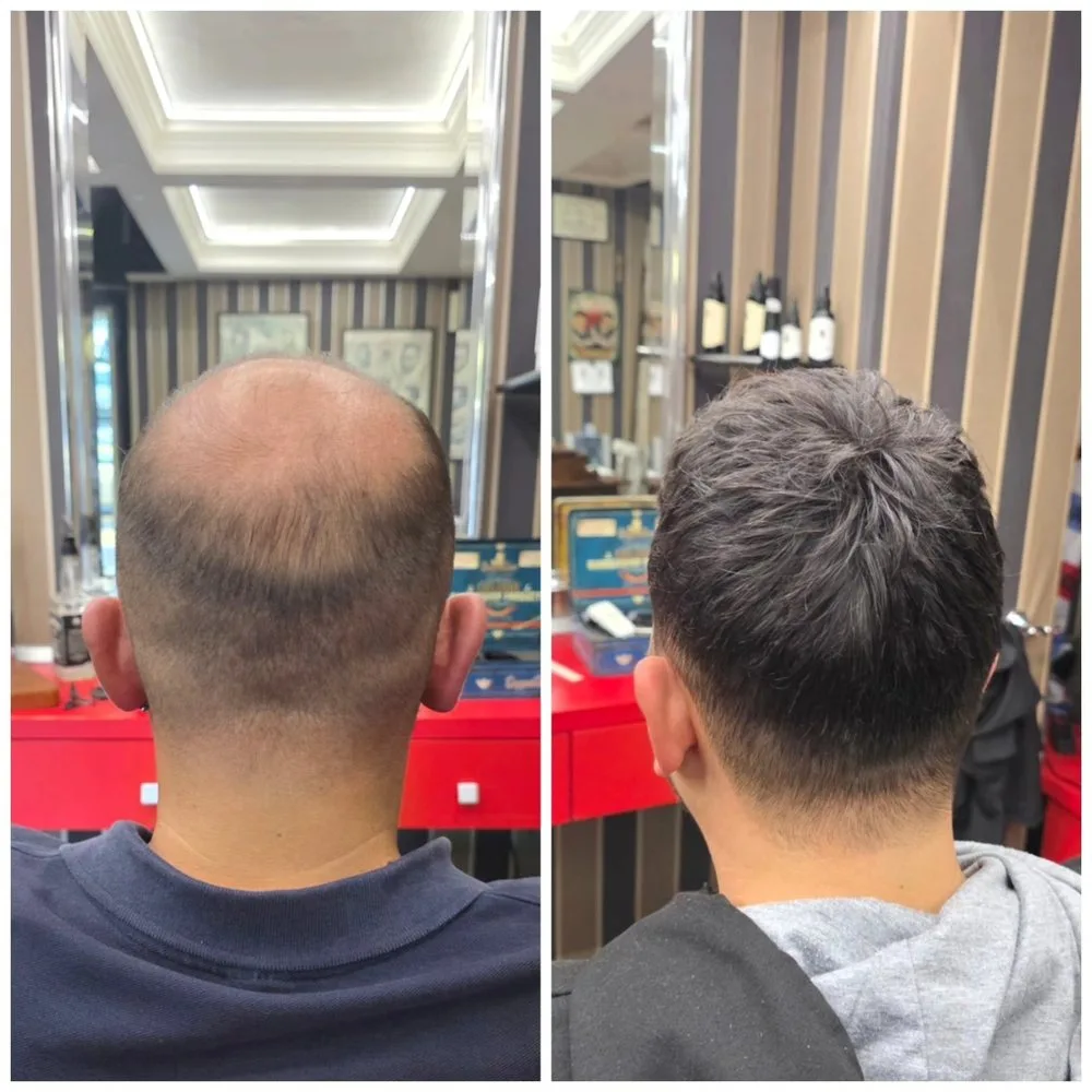 Prima e dopo una patch cutanea da Ciclopix Barber Shop, vista di spalle