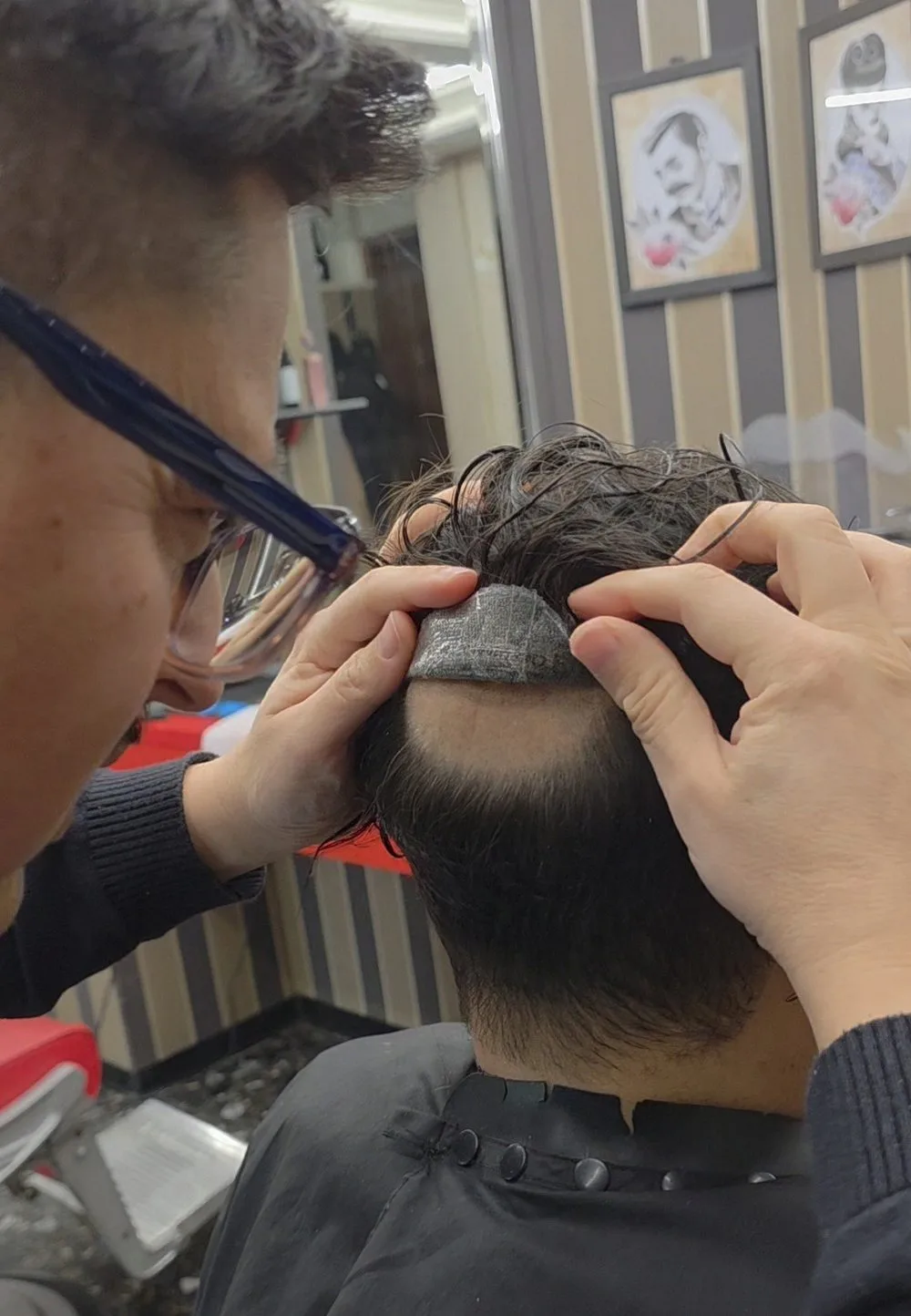 Applicazione di una patch cutanea da Ciclopix Barber Shop