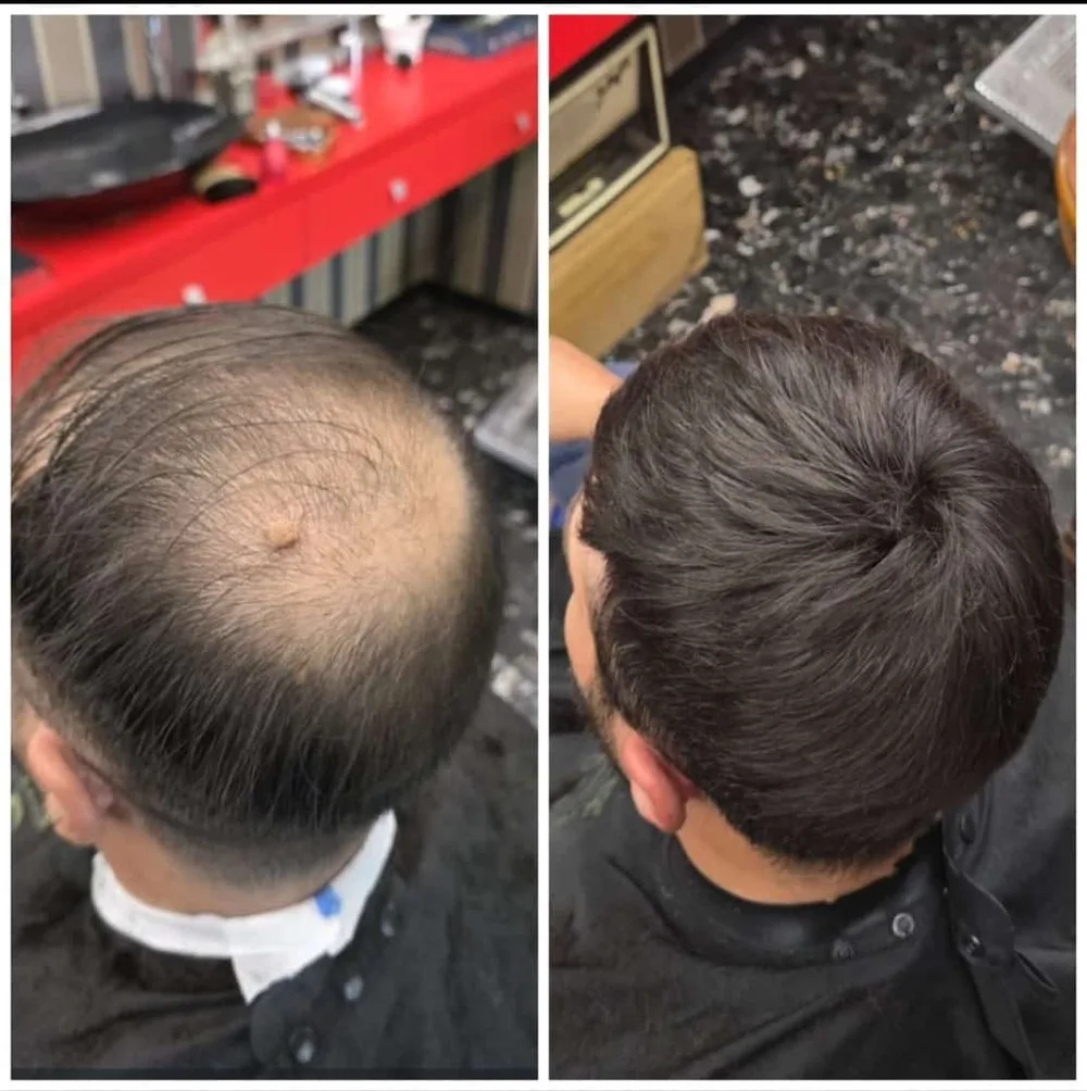 Prima e dopo una patch cutanea da Ciclopix Barber Shop, visto dall'alto